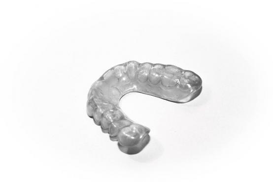 Conception de dentier sur-mesure