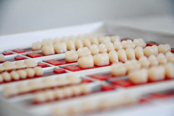 Prothèses de dents individuelles